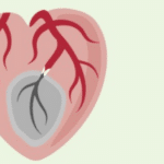 Gesunde Gefäße - gesundes Herz. Den Herzinfarkt vermeiden